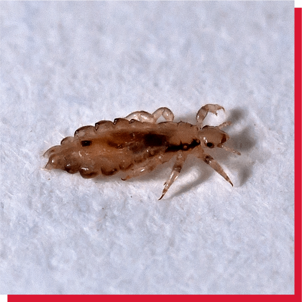 Signs Of Head Lice - Vamousse