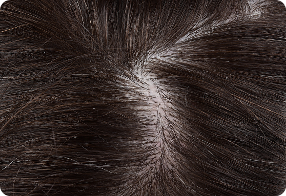 Nizoral_SG_DDCwebsite_review-day2_web