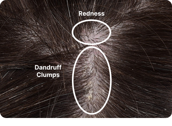 Nizoral_SG_DDCwebsite_review-day1_web