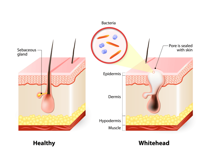 Papulex website images